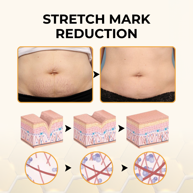 Timilk® ReviveSkin Bee Venom Firming Cream✅Firm & Glow in Just 21 Days
