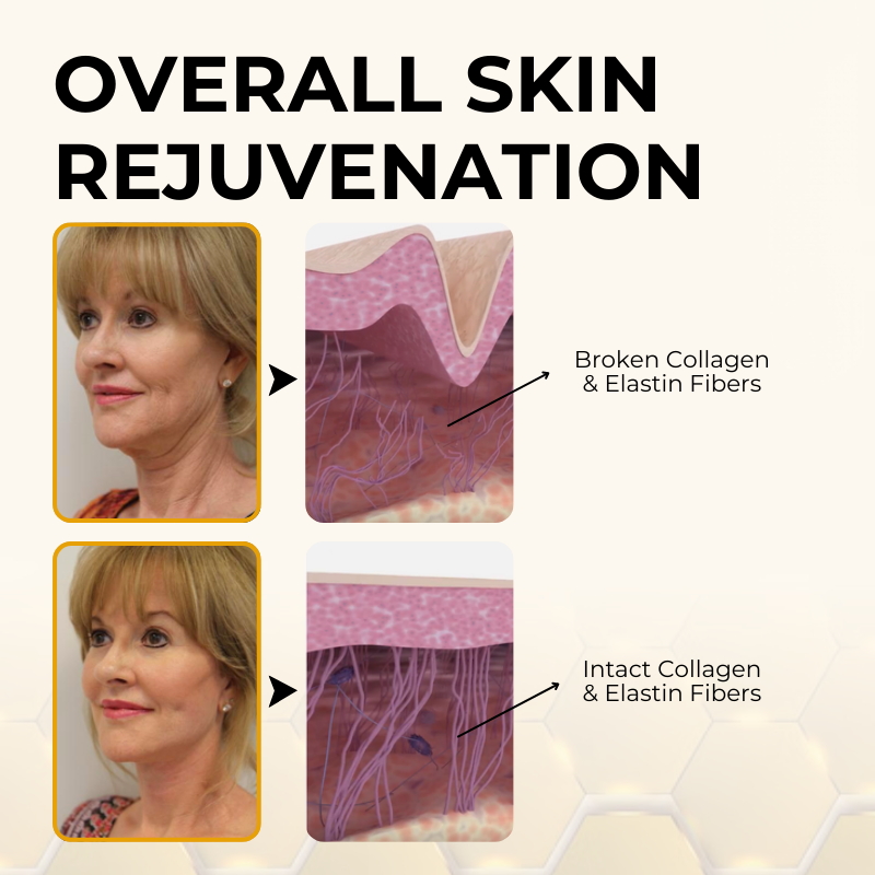 Timilk® ReviveSkin Bee Venom Firming Cream✅Firm & Glow in Just 21 Days