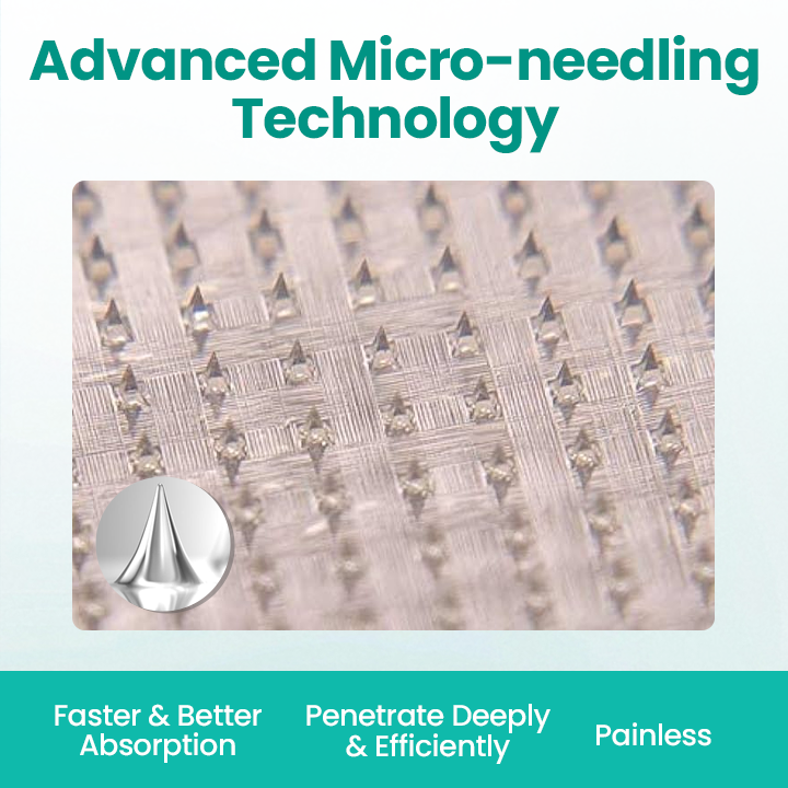 Timilk® LegRenew Varicose Veins Patch💧 24h Relief Microneedle Patch – Naturally Fade Varicose Veins