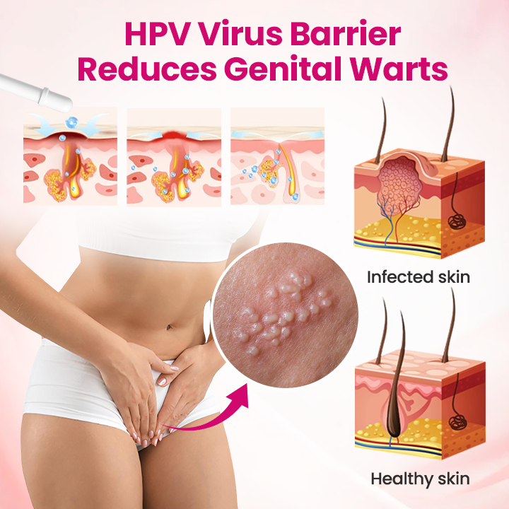 Timilk® IntiDefend Anti-HPV Interferon Gel -