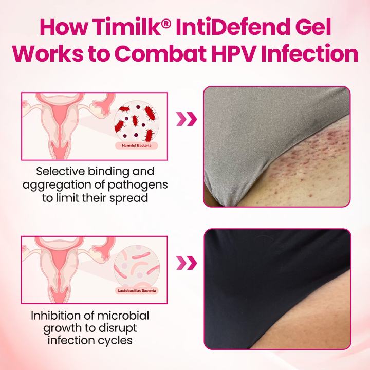 Timilk® IntiDefend Anti-HPV Interferon Gel -