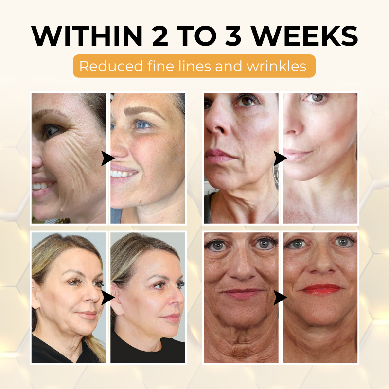 Timilk® ReviveSkin Bee Venom Firming Cream✅Firm & Glow in Just 21 Days
