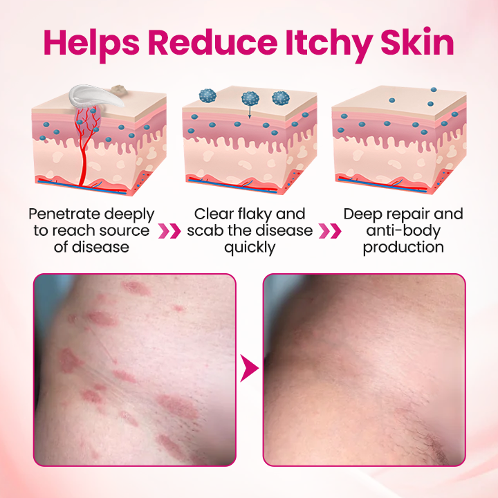 Timilk® IntiDefend Anti-HPV Interferon Gel -