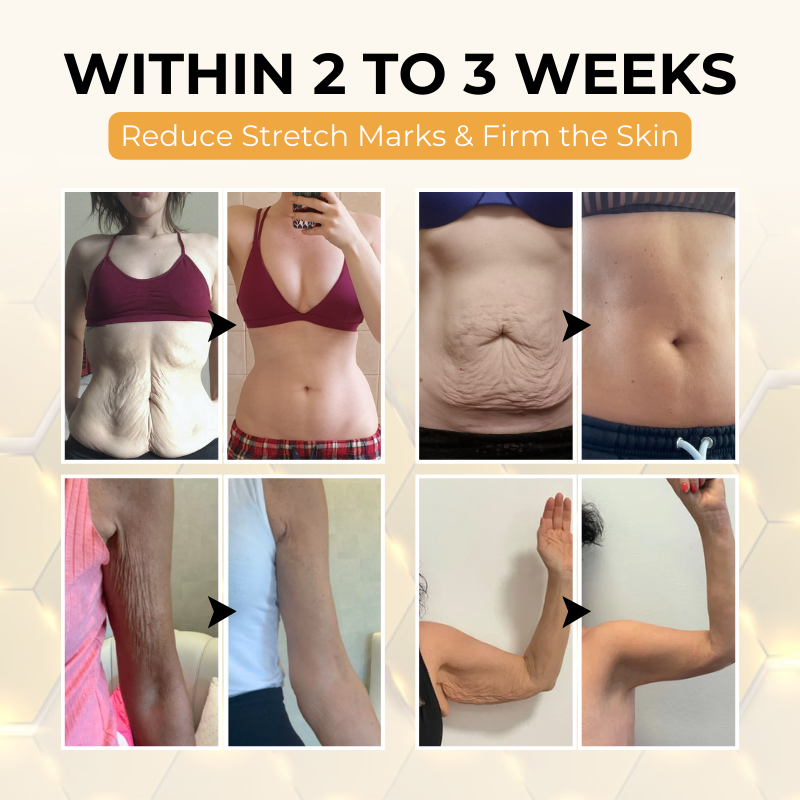 Timilk® ReviveSkin Bee Venom Firming Cream✅Firm & Glow in Just 21 Days