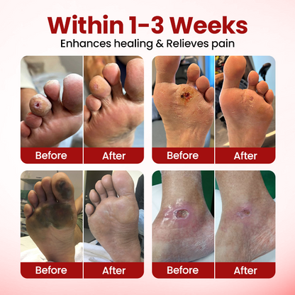 Timilk® VitaGluco Diabetic Care Cream — 48-Hour Visible Swelling Relief