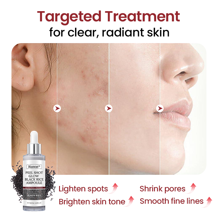 Biancat® Peel Shot Glow Black Rice Ampoule