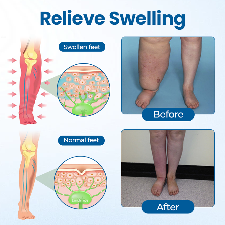Timilk® Lymphora Swelling Relief Roll-On