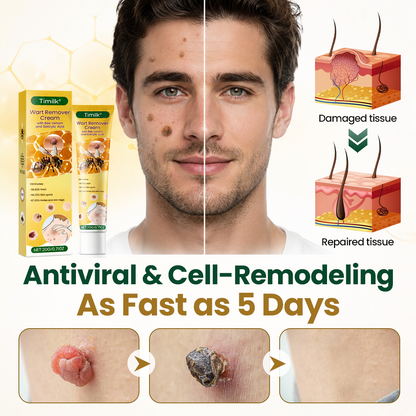 Timilk® Wart Remover Cream with Bee Venom and Salicylic Acid – Skin Tag Removal & Skin Repair Formula for Face and Body
