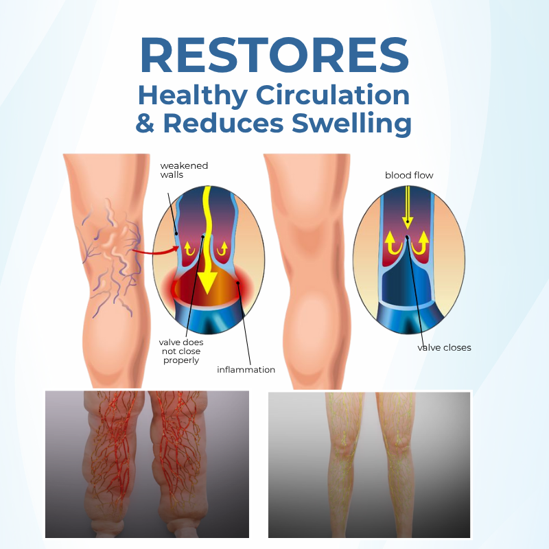 Timilk® TheraVein Varicose Herbal Spray