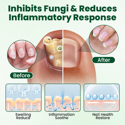 Timilk® Nail Repair Nourish Gel.