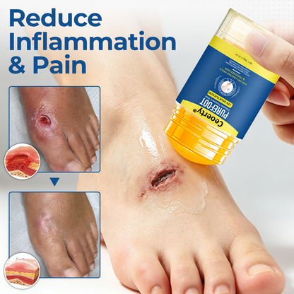 Ceoerty® PureFoot Diabetes Treatment Stick