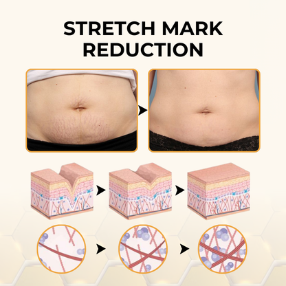 Timilk® ReviveSkin Bee Venom Firming Cream✅Firm & Glow in Just 21 Days