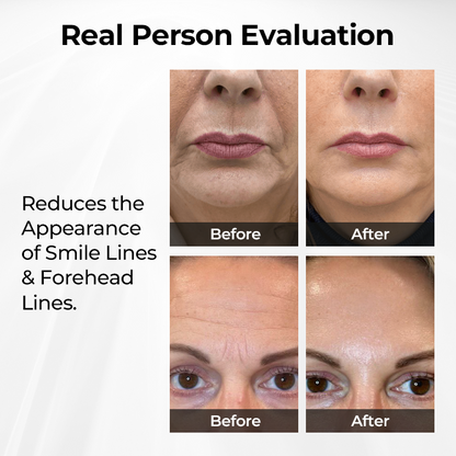 Biancat® TightShift Precision Contour & Firming Serum