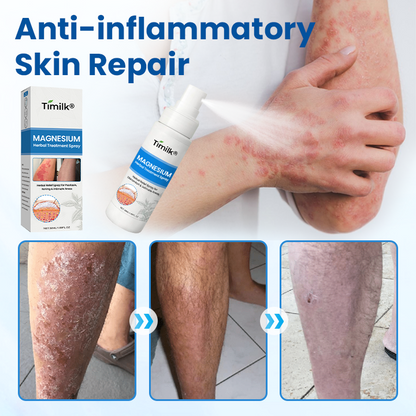 Timilk® PCA Magnesium Deep Repair Spray