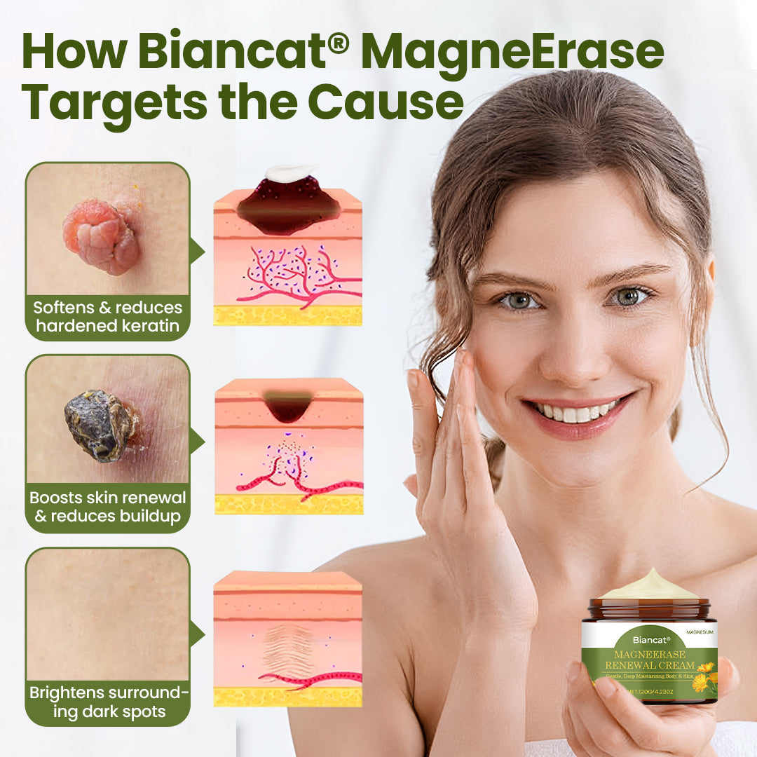 Biancat® MagneErase Renewal Cream