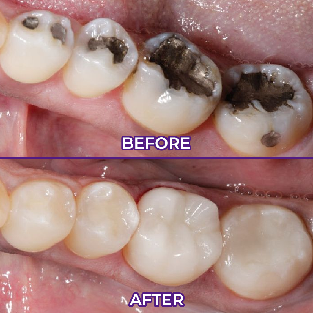 Ceoerty® VioletX Advanced Whitening Complex