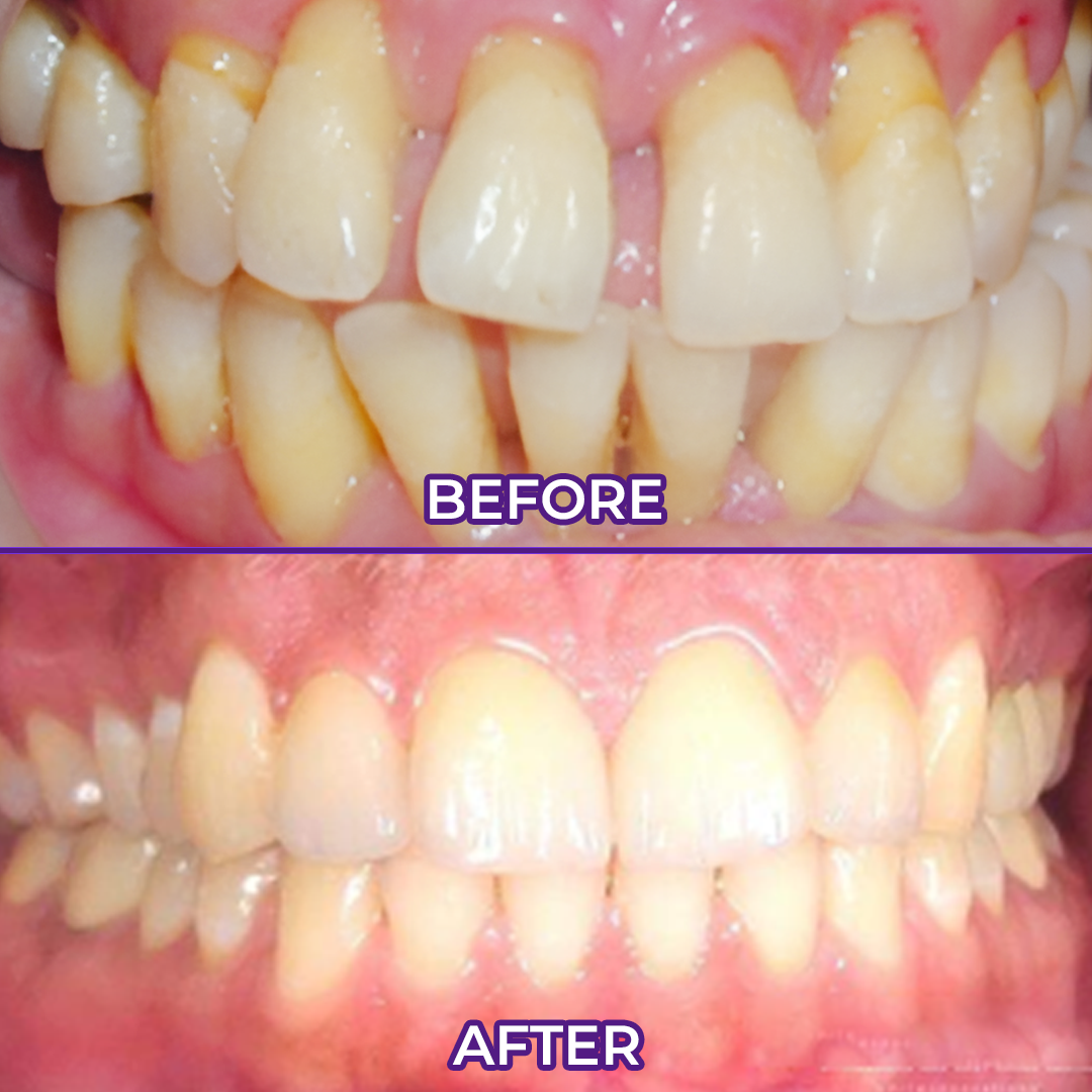 Ceoerty® VioletX Advanced Whitening Complex