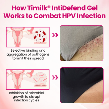 Timilk® IntiDefend Anti-HPV Interferon Gel -