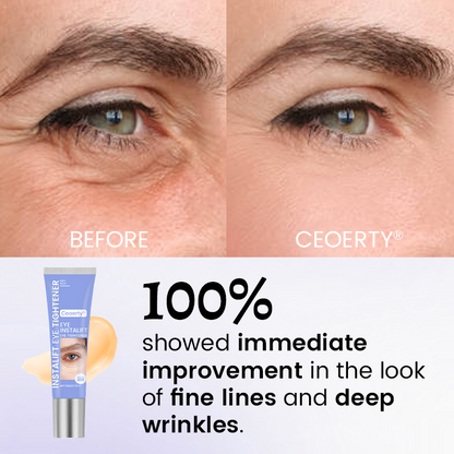 Ceoerty® InstaLift Eye Tightener – 10 Seconds to Younger, Fresher Eyes