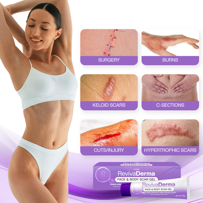 Timilk® RevivaDerma Face & Body Scar Gel - Clinically proven to soften, flatten and fade surgical scars, acne marks, burns, keloids and trauma-related scars