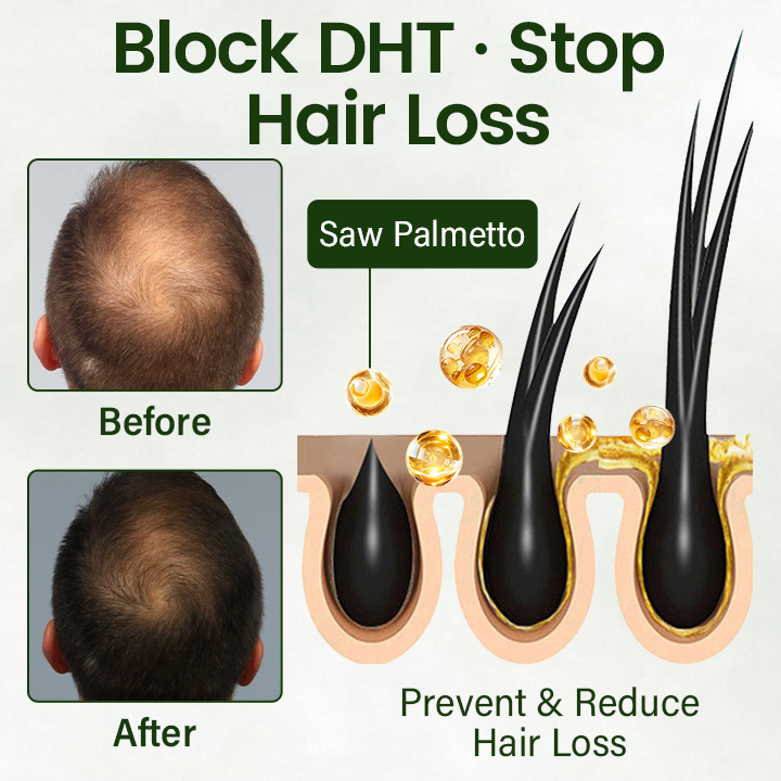 Timilk® Follicure BioGrow Hair Restoration Spray ( Reawaken Your Roots. Regrow Naturally. ✨ Clinically Proven Hair Regrowth Within 4 Weeks ✨)