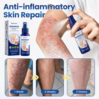Biancat® PsoriaMucin No-Rub Itch & Flake Relief Mist