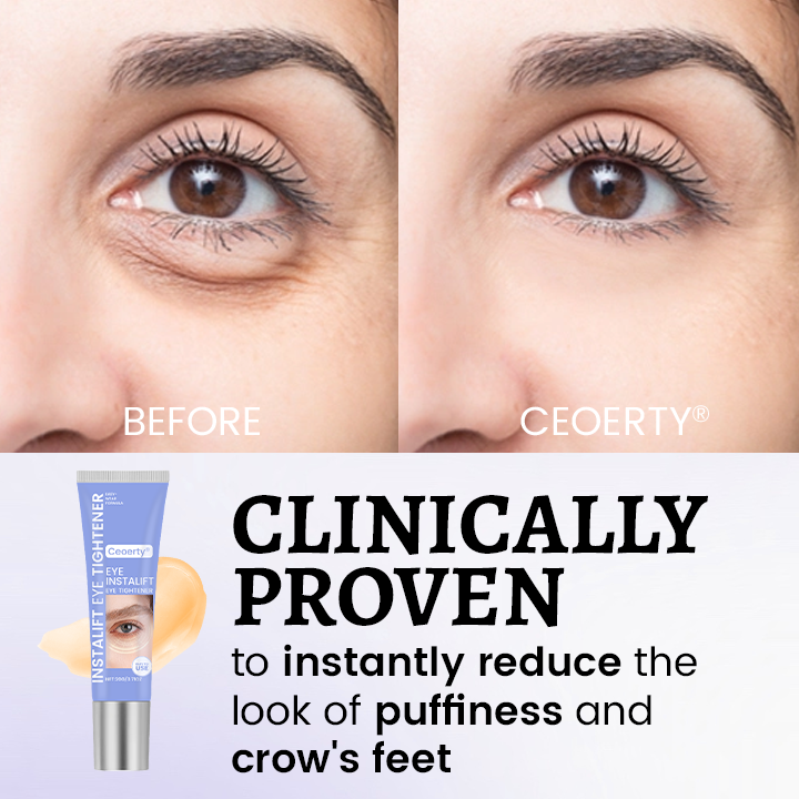 Ceoerty® InstaLift Eye Tightener – 10 Seconds to Younger, Fresher Eyes