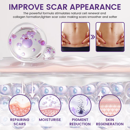 Timilk® ReGenScar Stem Cell Scar Gel-1