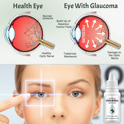 Ceoerty™ Myopia Reversal Eye Drop -