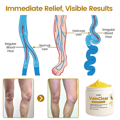 Timilk® VeinClear Bienengiftcreme |✨ Sichtbare Linderung in nur 7 Tagen! 🦵🌿