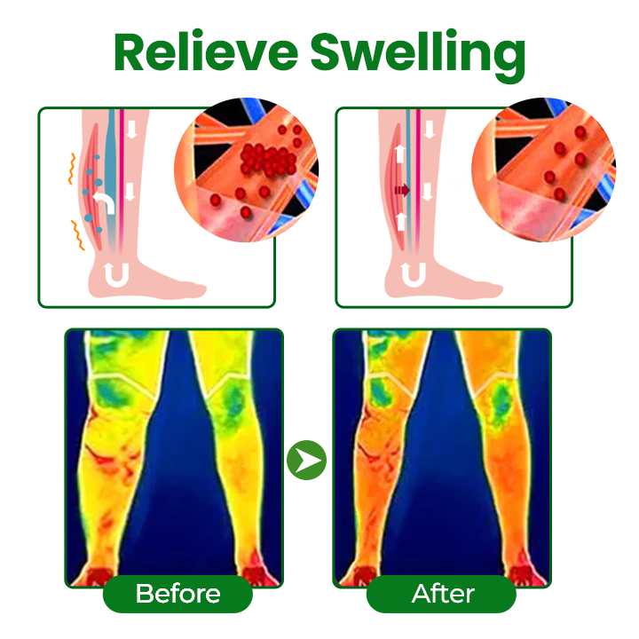 Timilk® VenoLift Leg Relief Spray -