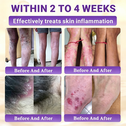 Timilk® Biotin 10-in-1 Skin Restoration Cream