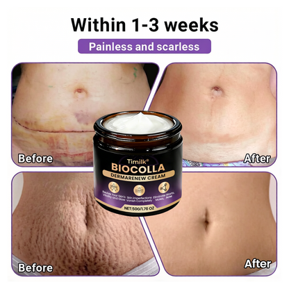 Timilk® BioColla DermaRenew Cream