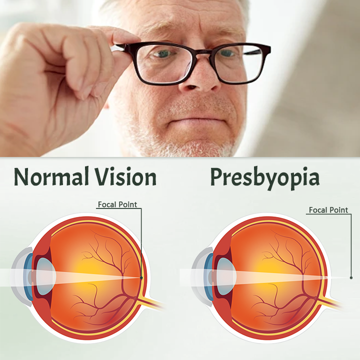 Ceoerty™ Myopia Reversal Eye Drop -