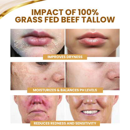 Timilk® DermSerene Beef Tallow Honey Balm