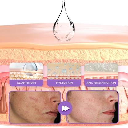 Timilk® RevivaDerma Face & Body Scar Gel - Clinically proven to soften, flatten and fade surgical scars, acne marks, burns, keloids and trauma-related scars