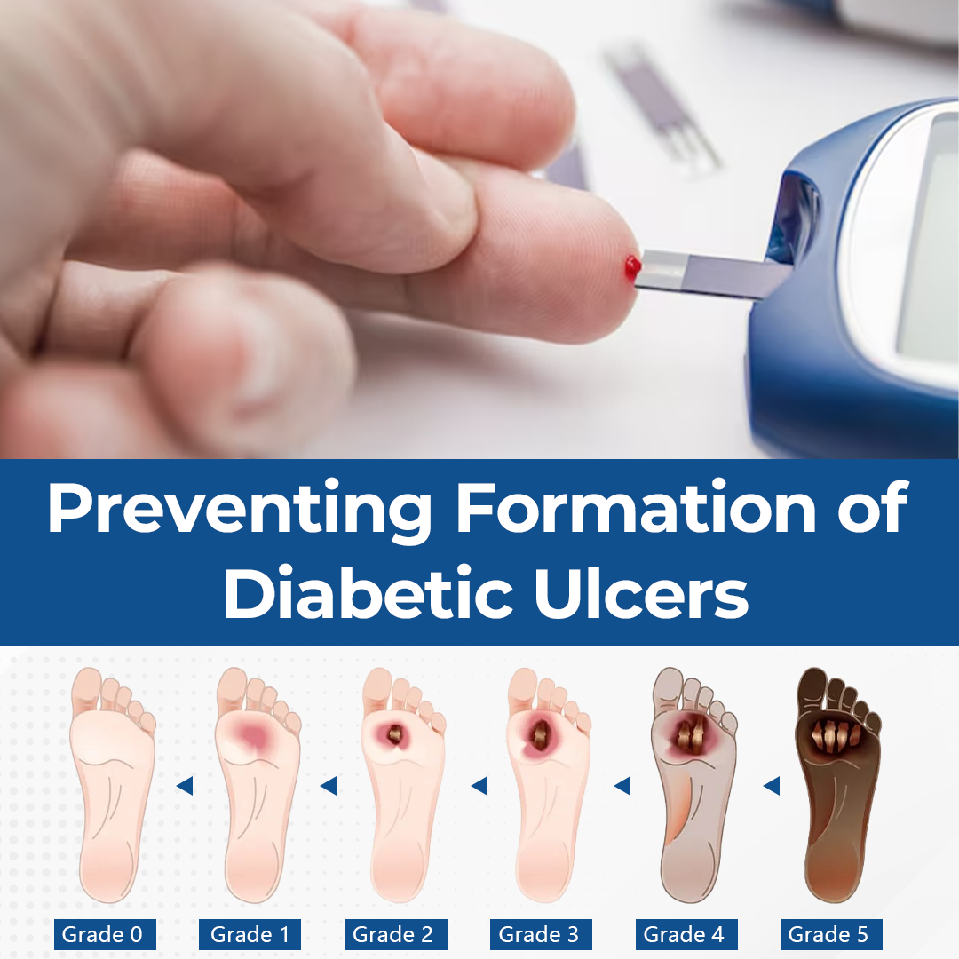Ceoerty® PureFoot Diabetes Treatment Stick