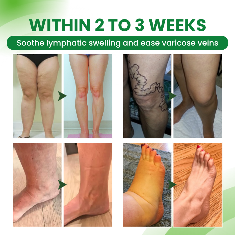 Timilk® SwellEase Lymphatic Support Roll-On