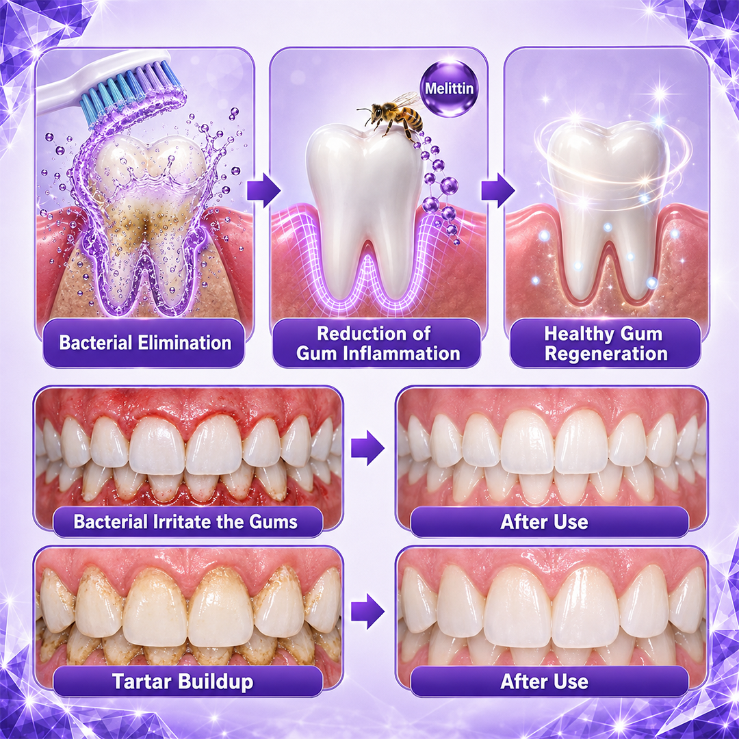 Ceoerty® Gingivitis Periodontal Treatment Toothpaste