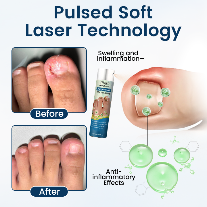 Timilk® OnyxiGuard Fungal Repair Herbal Spray