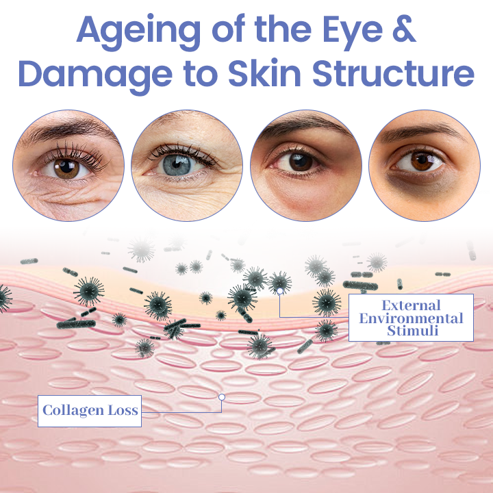 Ceoerty® InstaLift Eye Tightener – 10 Seconds to Younger, Fresher Eyes