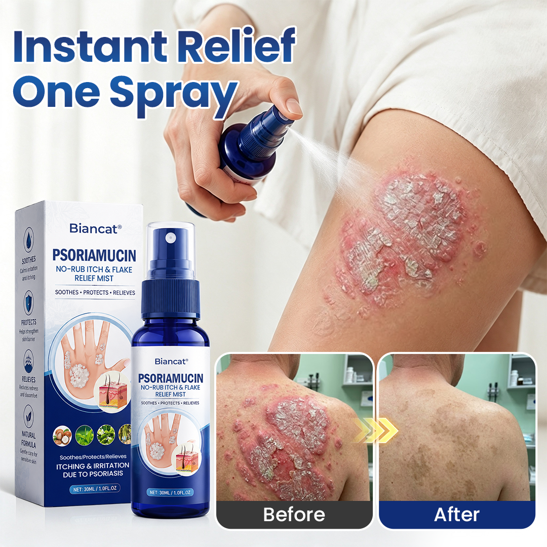 Biancat® PsoriaMucin No-Rub Itch & Flake Relief Mist