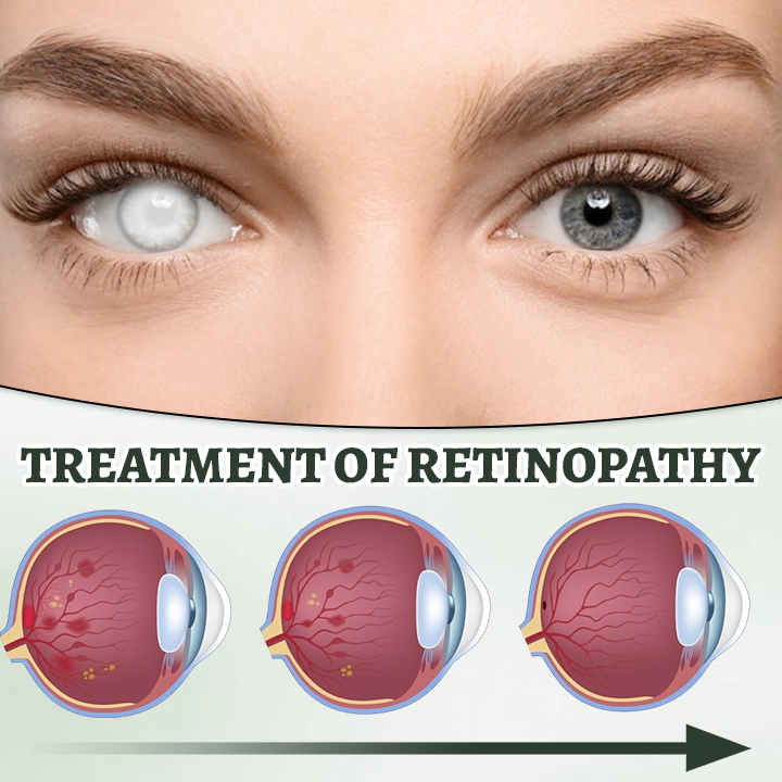 Ceoerty™ Myopia Reversal Eye Drop -