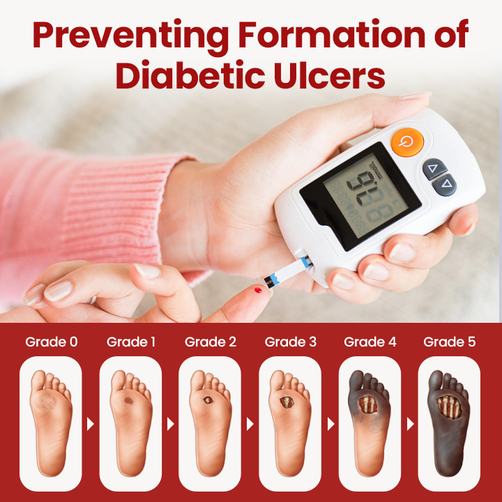 Timilk® VitaGluco Diabetic Care Cream — 48-Hour Visible Swelling Relief