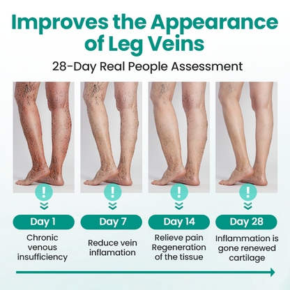 Timilk® LegRenew Varicose Veins Patch💧 24h Relief Microneedle Patch – Naturally Fade Varicose Veins
