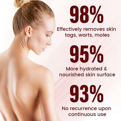 Timilk® Vionara Nano WartErase Patch