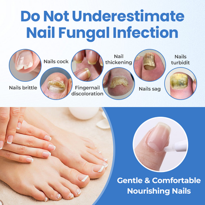 Timilk® MycoErase Nail Revive Pen