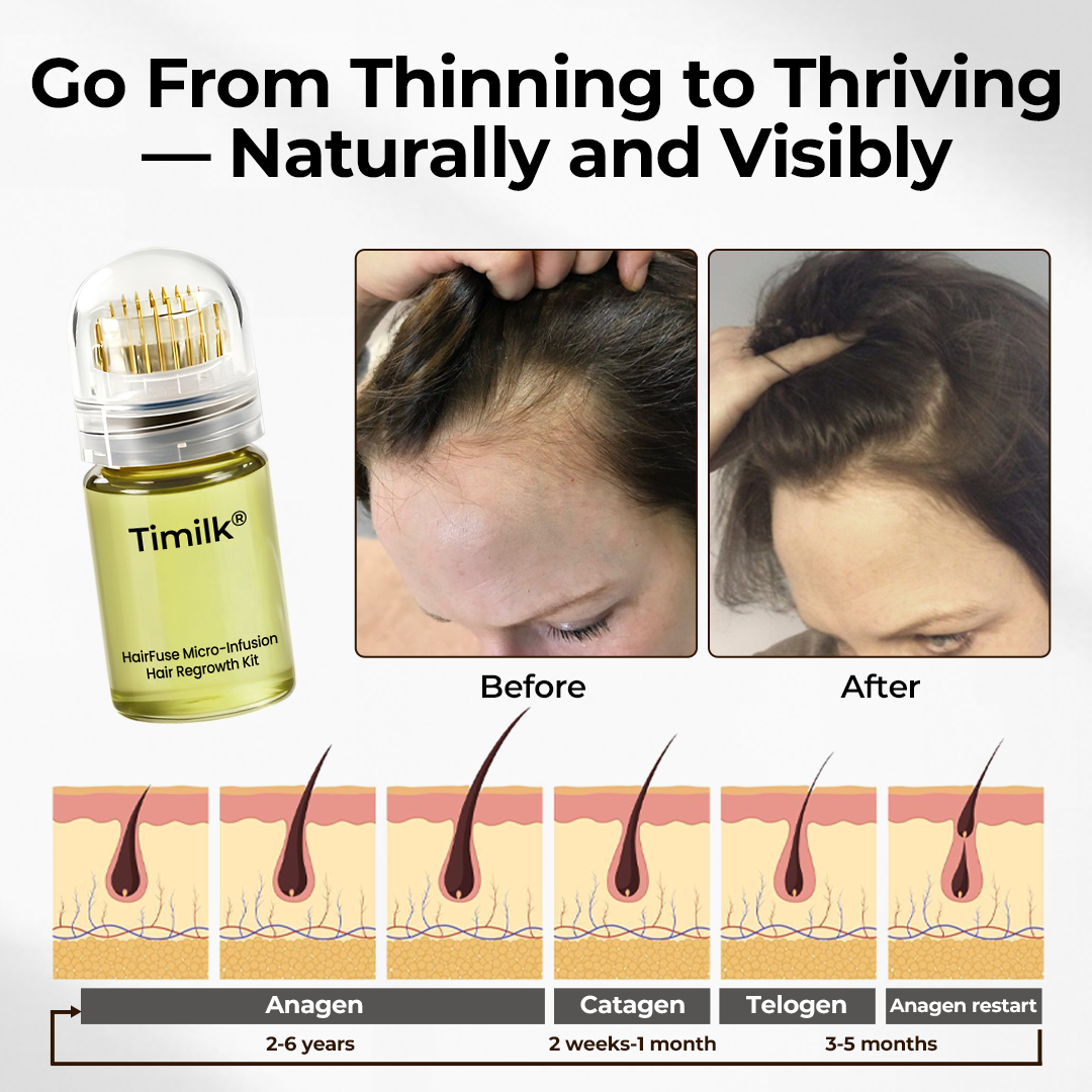 Timilk® HairFuse Micro-Infusion Hair Regrowth Kit