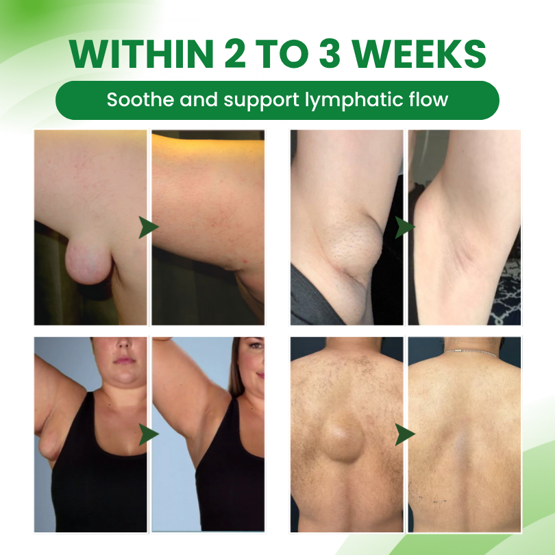Timilk® SwellEase Lymphatic Support Roll-On