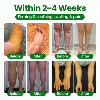 Timilk® VenoLift Leg Relief Spray -